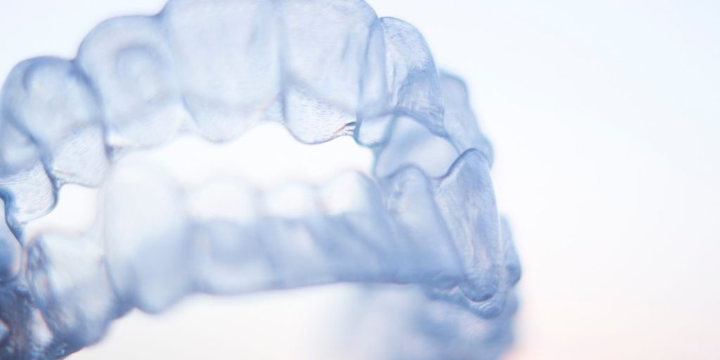 Retention of braces