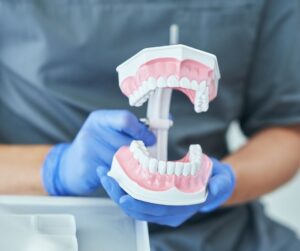 Dental model held by gloved hands.