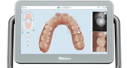 iTero Scanner