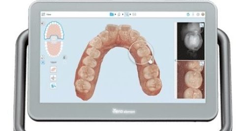 iTero Scanner